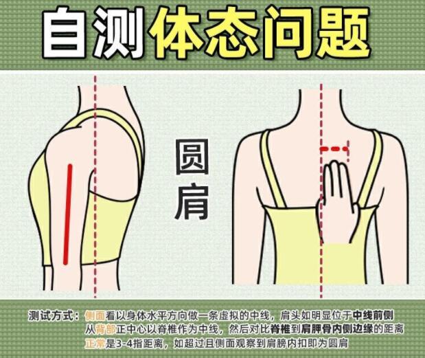 你真的是驼背吗？广西美容美体学校教你自测