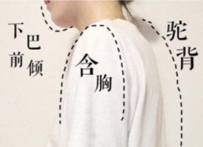 南宁美容学校：坚持一个月，驼背变直背