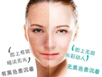南宁美容学校：皮肤什么暗沉发黄