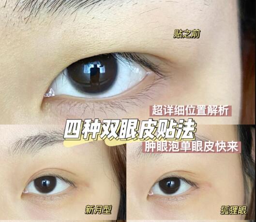 化妆技巧：双眼皮贴法大全超详细教程