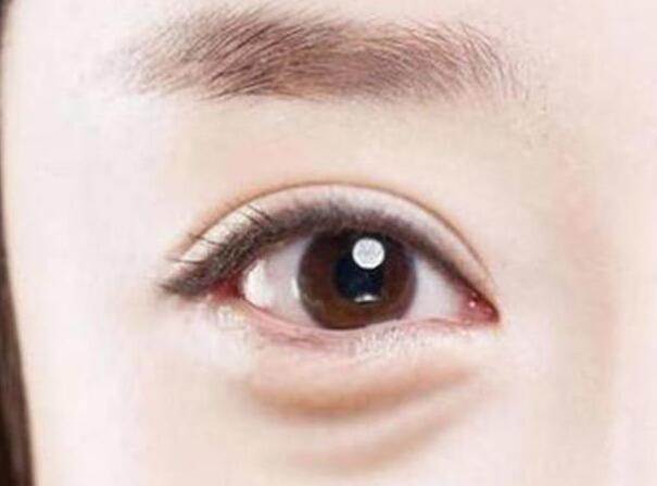 眼袋？泪沟？卧蚕？南宁美容学校教你辨别
