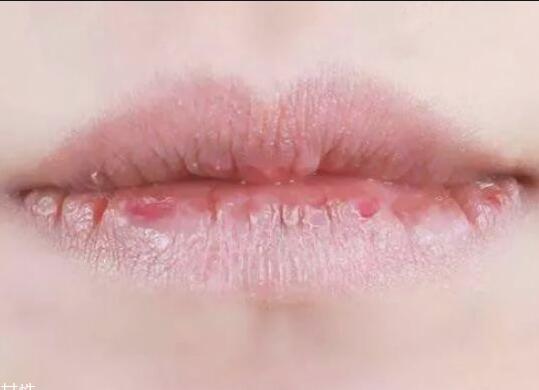 纹唇后嘴巴干燥怎么办？南宁教纹绣的学校帮你解决