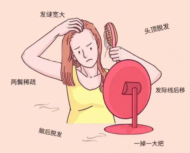 如何缓解脱发？广西头疗养生培训学校分享