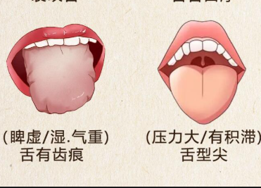 如何根据舌苔看健康 | 广西美容美体培训哪里正规